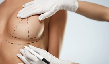 Can Breast Reduction Surgery Make Your Breasts Perky?