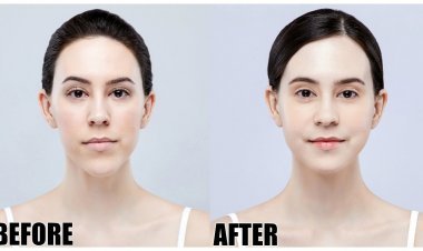 Plastic Surgery in Pakistan