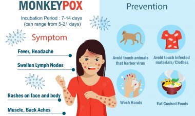 Monkeypox Virus in Pakistan